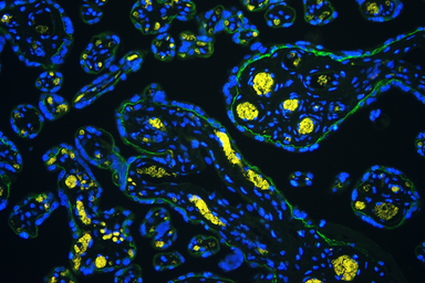 Anti-Integrin alpha 5 antibody used in IHC (Paraffin sections) (IHC-P). GTX35249