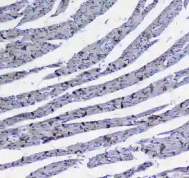 Anti-Integrin alpha 5 antibody used in IHC (Paraffin sections) (IHC-P). GTX35249