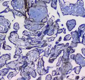 Anti-Integrin alpha 5 antibody used in IHC (Paraffin sections) (IHC-P). GTX35249