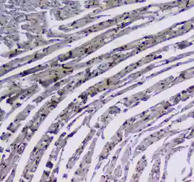 Anti-Integrin alpha 5 antibody used in IHC (Paraffin sections) (IHC-P). GTX35249