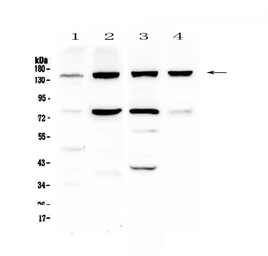 Anti-Integrin alpha 5 antibody used in Western Blot (WB). GTX35249