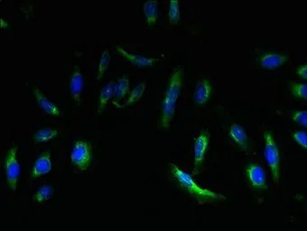 Anti-EMP3 antibody used in Immunocytochemistry/ Immunofluorescence (ICC/IF). GTX35254