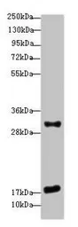 Anti-EMP3 antibody used in Western Blot (WB). GTX35254