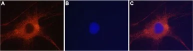 Anti-GluR6 antibody used in Immunocytochemistry/ Immunofluorescence (ICC/IF). GTX35259