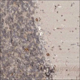Anti-CDC14B antibody used in IHC (Paraffin sections) (IHC-P). GTX36294