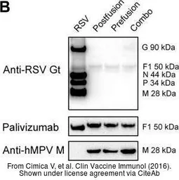 Anti-Human metapneumovirus Nucleoprotein antibody [4821] used in Western Blot (WB). GTX36792