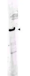 Anti-ROBO1 antibody used in Western Blot (WB). GTX36928