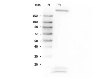 Anti-ROBO1 antibody used in Western Blot (WB). GTX36928