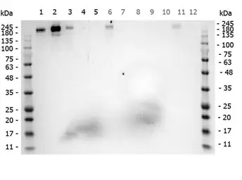 Anti-ROBO1 antibody used in Western Blot (WB). GTX36928