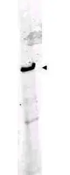Anti-ROBO1 antibody used in Western Blot (WB). GTX36928