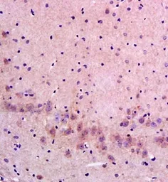 Anti-FLIP antibody used in IHC (Paraffin sections) (IHC-P). GTX37264