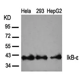 Anti-IKB epsilon antibody used in Western Blot (WB). GTX37290