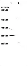 Anti-LIGHT antibody used in Western Blot (WB). GTX37328