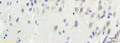 Anti-TGM3 antibody used in IHC (Paraffin sections) (IHC-P). GTX37332