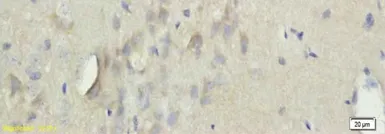 Anti-TGM3 antibody used in IHC (Paraffin sections) (IHC-P). GTX37332