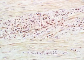 Anti-RNF126 antibody used in IHC (Paraffin sections) (IHC-P). GTX37349