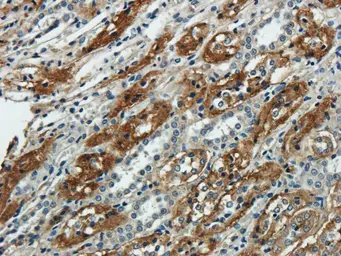 Anti-NTCP antibody used in IHC (Paraffin sections) (IHC-P). GTX37362