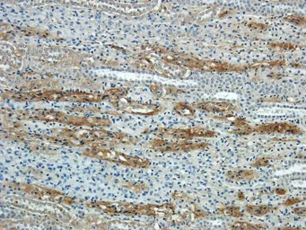 Anti-NTCP antibody used in IHC (Paraffin sections) (IHC-P). GTX37362