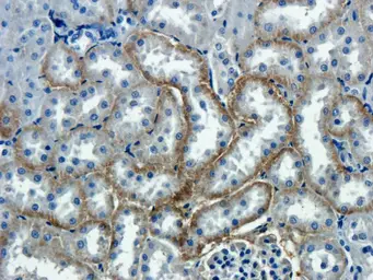 Anti-NTCP antibody used in IHC (Paraffin sections) (IHC-P). GTX37362