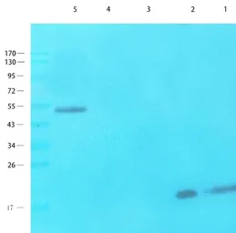 Anti-NTCP antibody used in Western Blot (WB). GTX37362