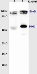 Anti-REST antibody used in Western Blot (WB). GTX37363