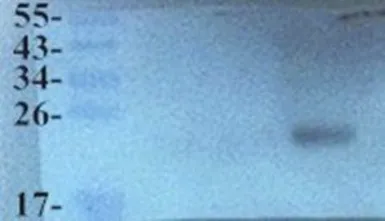 Anti-CD303 antibody used in Western Blot (WB). GTX37364