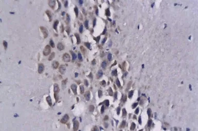 Anti-MCP3 antibody used in IHC (Paraffin sections) (IHC-P). GTX37377