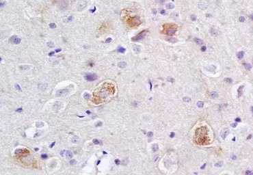 Anti-LRIG2 antibody used in IHC (Paraffin sections) (IHC-P). GTX37384