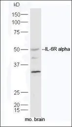 Anti-IL6 Receptor antibody used in Western Blot (WB). GTX37399