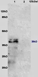 Anti-IL10 Receptor beta antibody used in Western Blot (WB). GTX37405