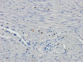 Anti-HOXA10 antibody used in IHC (Paraffin sections) (IHC-P). GTX37412