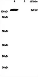 Anti-mGluR1 antibody used in Western Blot (WB). GTX37416