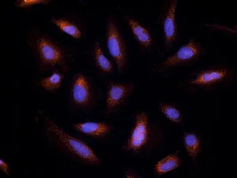Anti-Endothelin 1 antibody used in Immunocytochemistry/ Immunofluorescence (ICC/IF). GTX37427