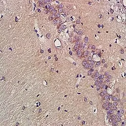 Anti-EAAT2 antibody used in IHC (Paraffin sections) (IHC-P). GTX37432