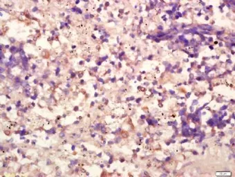 Anti-SLAMF7 antibody used in IHC (Paraffin sections) (IHC-P). GTX37440