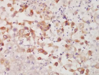 Anti-Cytokeratin 7 antibody used in IHC (Paraffin sections) (IHC-P). GTX37442