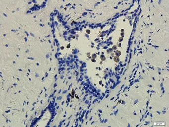 Anti-Cytokeratin 7 antibody used in IHC (Paraffin sections) (IHC-P). GTX37442