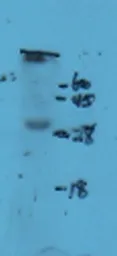 Anti-NKp44 antibody used in Western Blot (WB). GTX37443