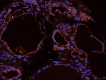 Anti-CD69 antibody used in IHC (Frozen sections) (IHC-Fr). GTX37447