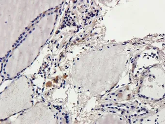 Anti-CD69 antibody used in IHC (Paraffin sections) (IHC-P). GTX37447