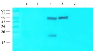 Anti-CD69 antibody used in Western Blot (WB). GTX37447