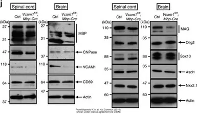 Anti-CD69 antibody used in Western Blot (WB). GTX37447