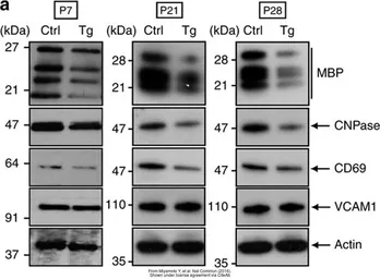 Anti-CD69 antibody used in Western Blot (WB). GTX37447