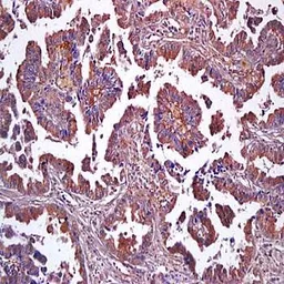 Anti-CD229 antibody used in IHC (Paraffin sections) (IHC-P). GTX37455