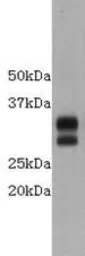 Anti-CD8 alpha antibody used in Western Blot (WB). GTX37508