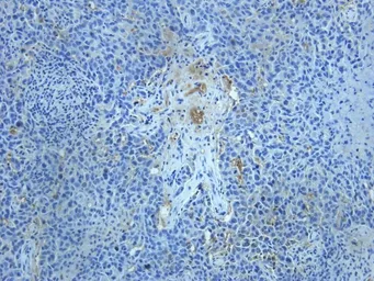 Anti-TGF beta Receptor 2 antibody used in IHC (Paraffin sections) (IHC-P). GTX37527
