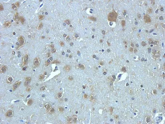 Anti-TGF beta Receptor 2 antibody used in IHC (Paraffin sections) (IHC-P). GTX37527