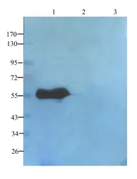 Anti-TGF beta Receptor 2 antibody used in Western Blot (WB). GTX37527