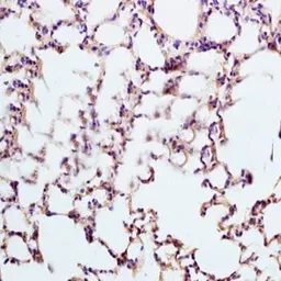 Anti-Surfactant Protein D antibody used in IHC (Paraffin sections) (IHC-P). GTX37537