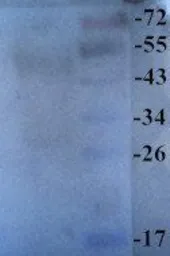 Anti-Surfactant Protein D antibody used in Western Blot (WB). GTX37537